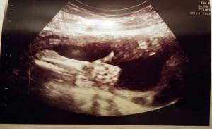 Baby's thumbs up!
